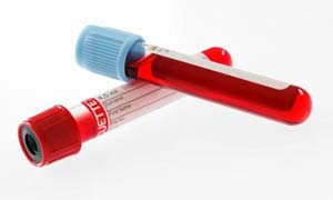 tubes de sang analyse tubes de sang analyse