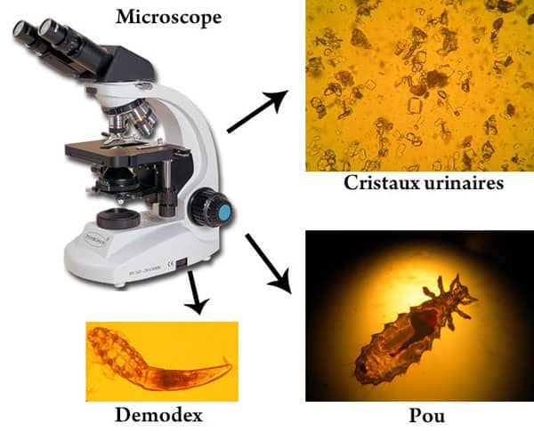 Microscopie vétérinaire parasite et analyse d'urine, poux au microscope